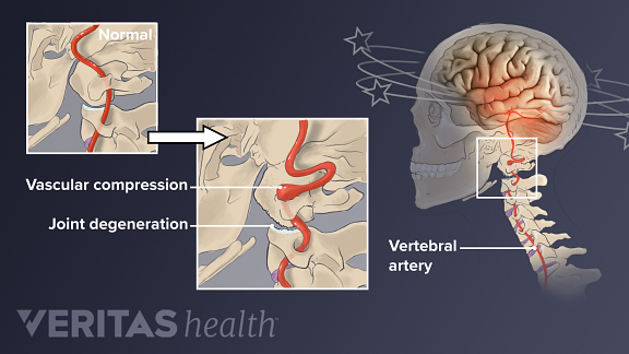 what can cause weight loss and dizziness