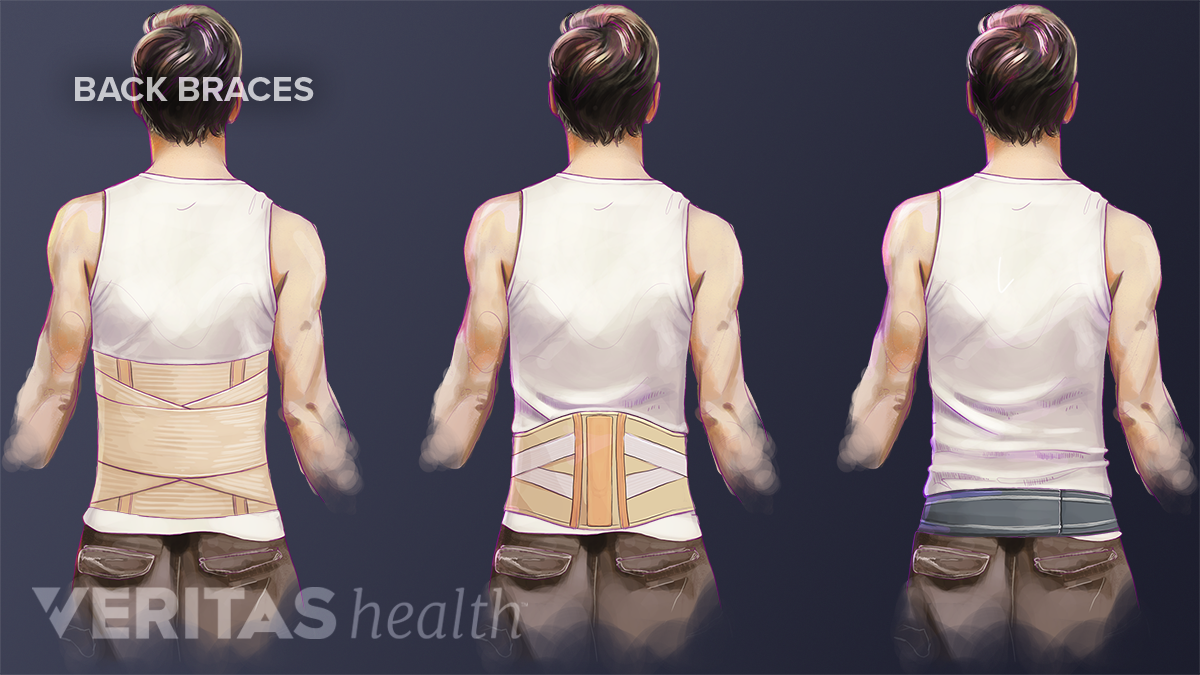 Types Of Back Braces Used For Lower Back Pain Relief