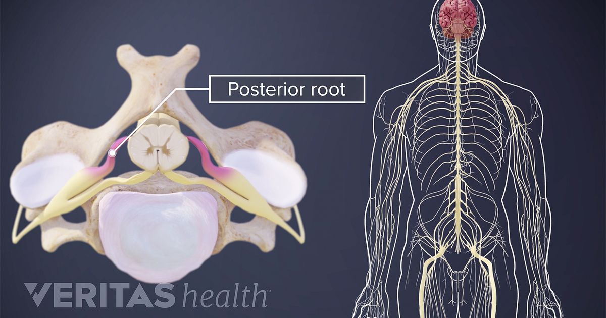 nerve-root-definition-back-pain-and-neck-pain-medical-glossary