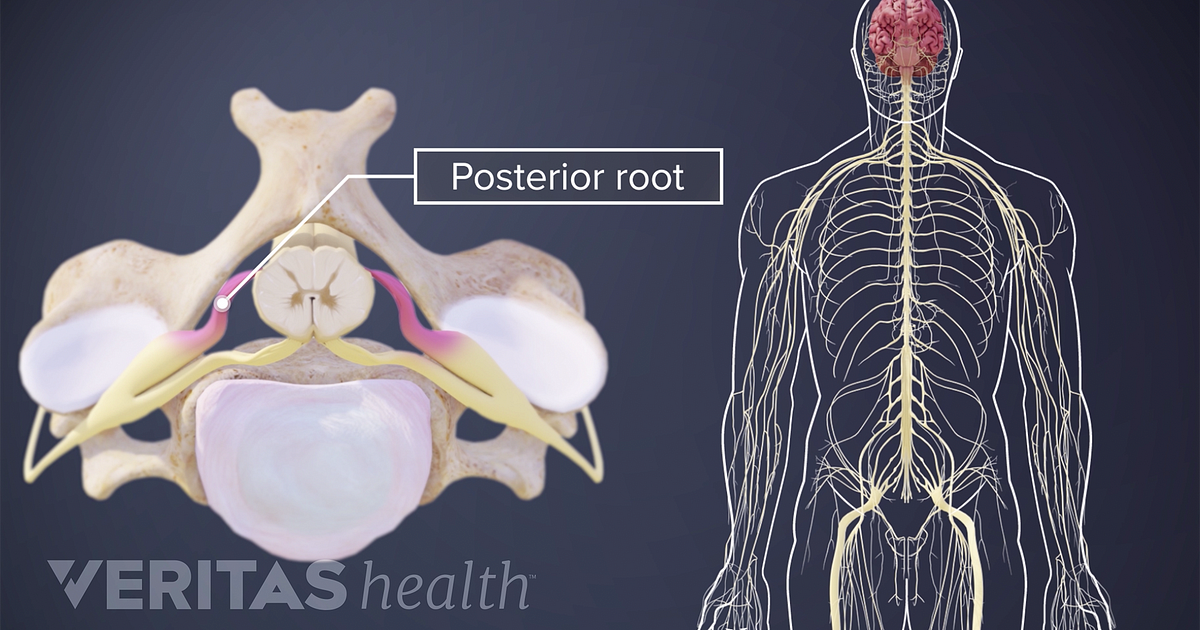 Nerve Root Definition Back Pain And Neck Pain Medical Glossary