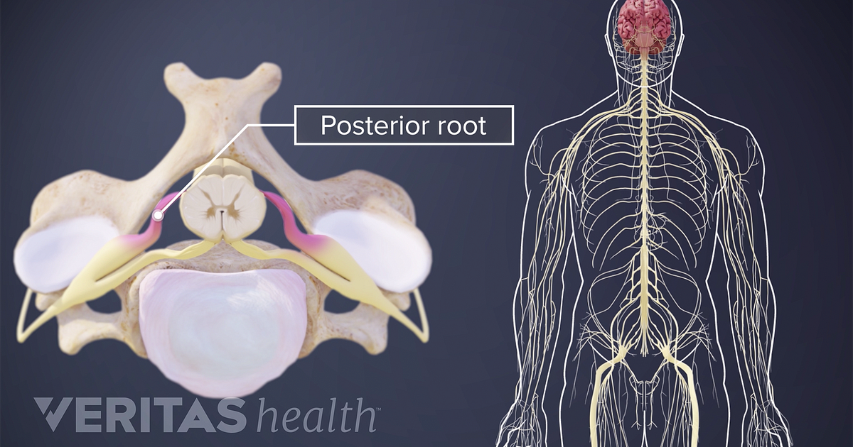 Nerve Root Definition Back Pain and Neck Pain Medical Glossary