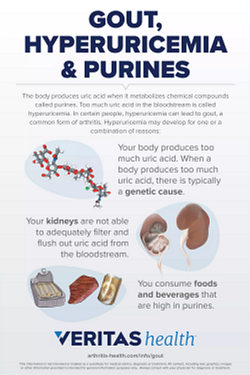 Infographic displaying details about gout, hyperuricemia and purines