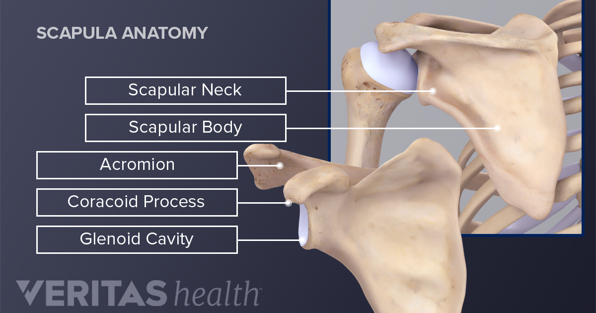 a broken shoulder scapula fracture