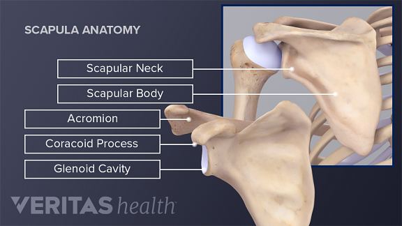 A Broken Shoulder: Scapula Fracture
