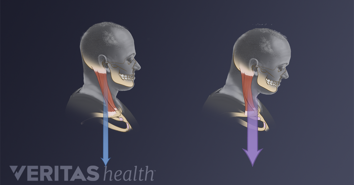 How To Measure And Fix Forward Head Posture