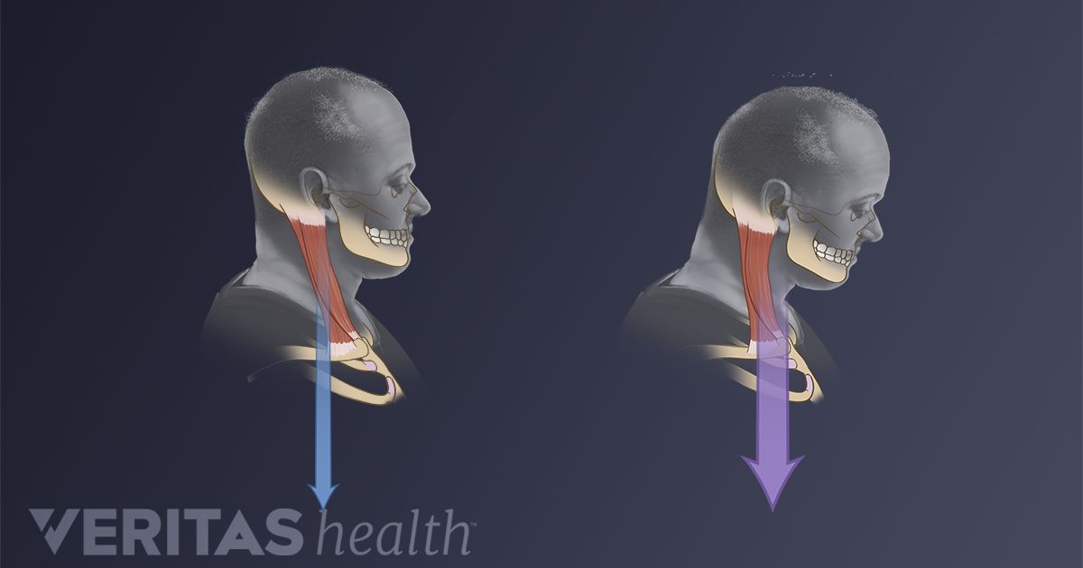 Identifying Incorrect Posture