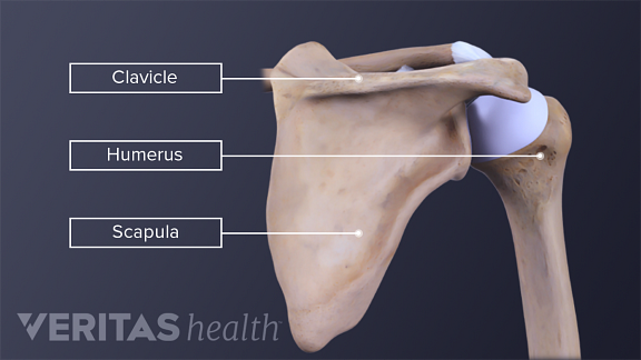 The 3 Types of Shoulder Fractures