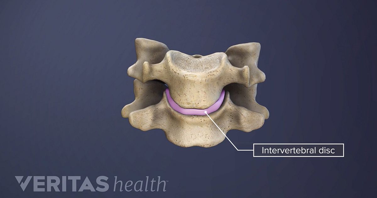 intervertebral-disc-definition-back-pain-and-neck-pain-medical-glossary