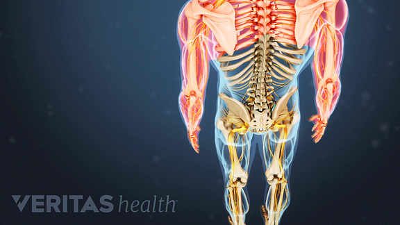 Cervical Radiculopathy Interactive Video