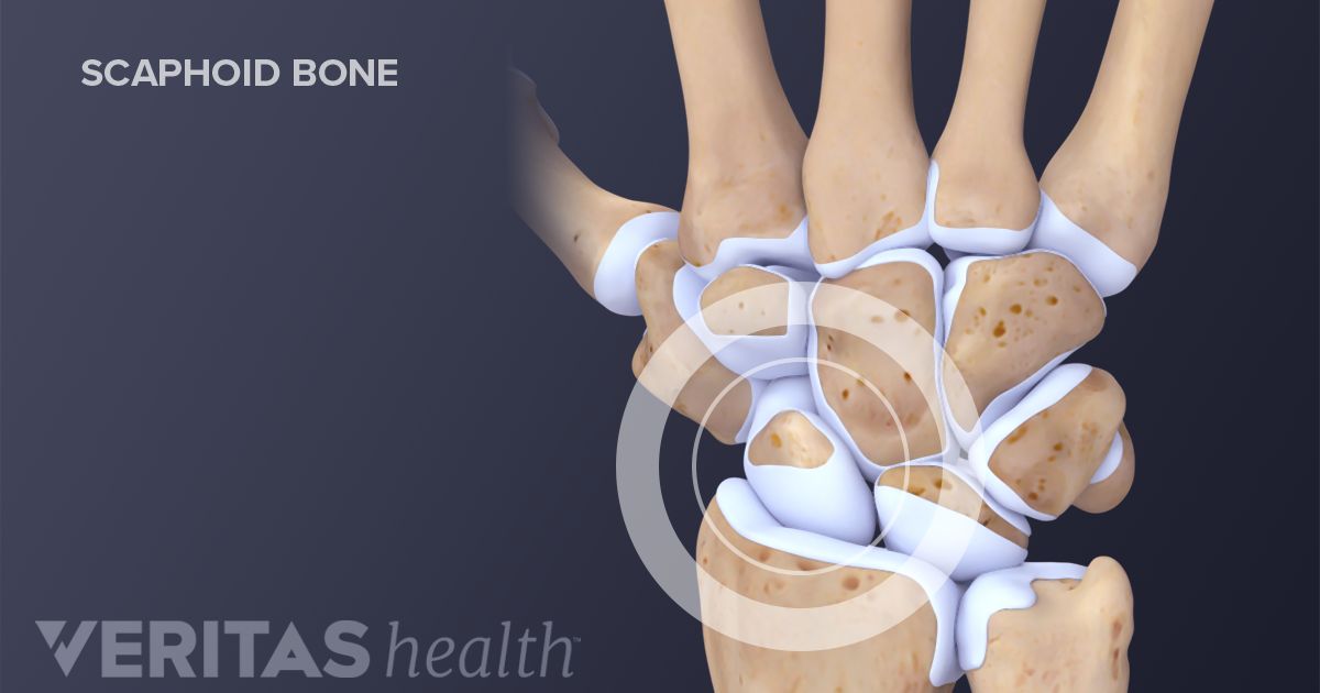 Less Common Types of Wrist Fractures