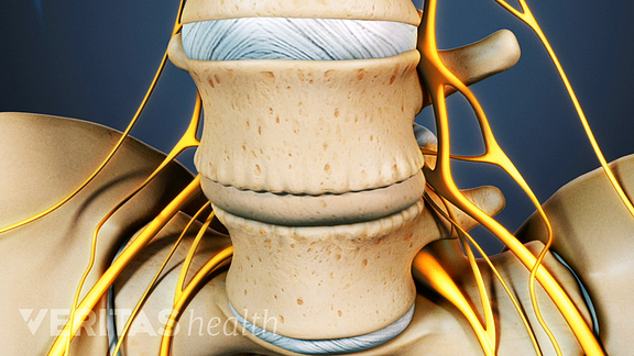 A Visual Guide to Ankylosing Spondylitis