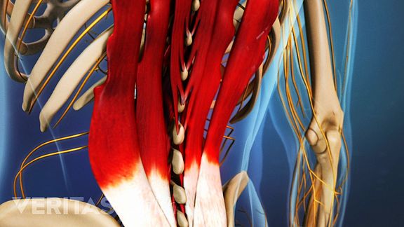 Lower Back Strain