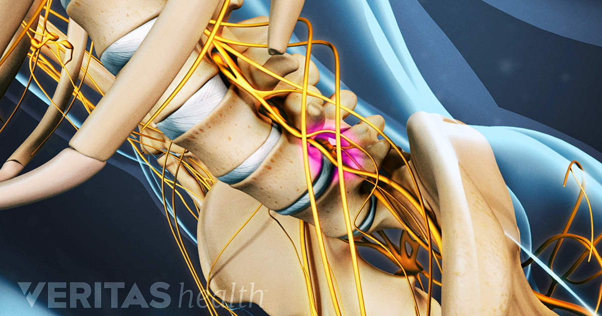 Sciatic Nerve Anatomy