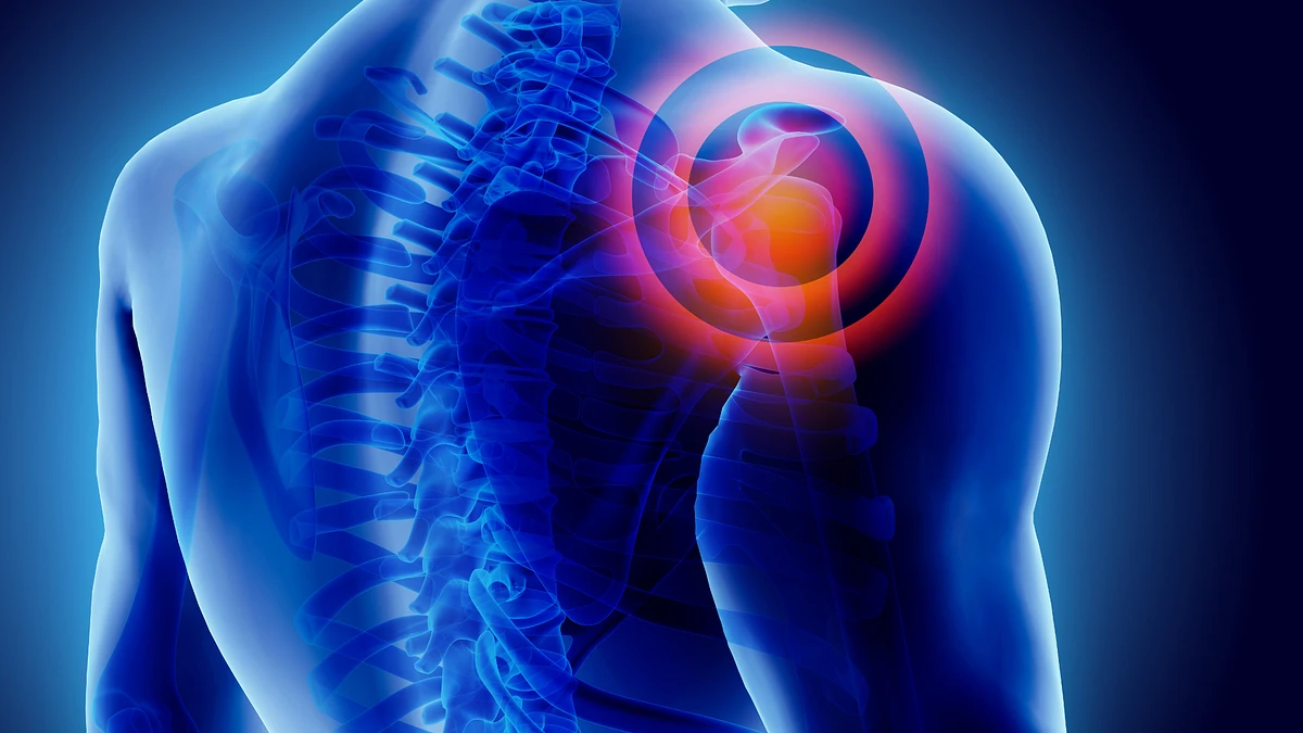 Pain in Both Shoulders: 8 Causes for Bilateral Shoulder Pain – San