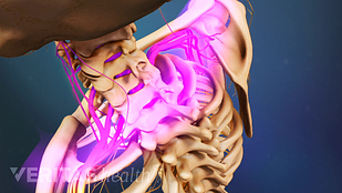how to relieve neck pain caused by stress