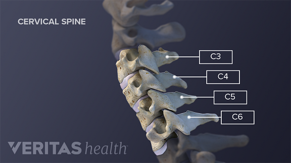 Các đốt sống cổ tử cung C3, C4, C5 và C6.