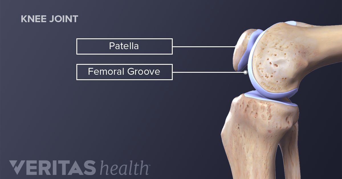 Patellofemoral Pain Syndrome Definition | Sports Injury-Related Medical ...