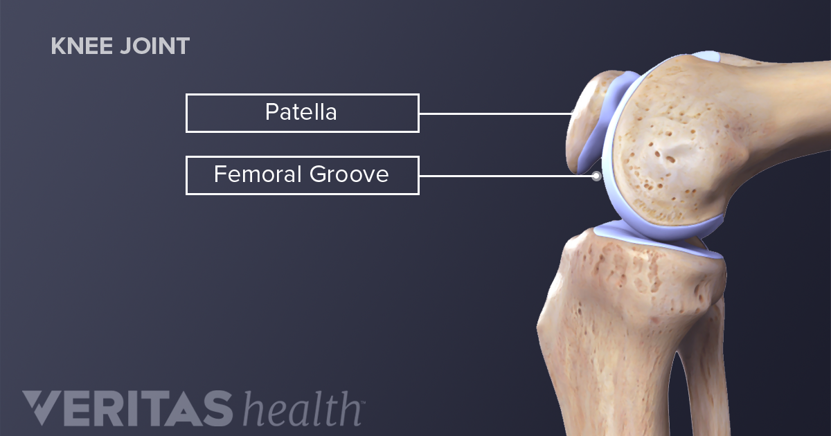 About Acute Patellar Injuries