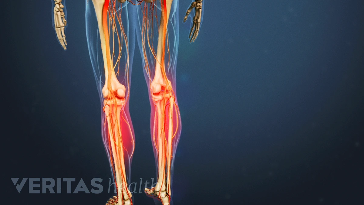 4 leg problems and what might be causing them - Harvard Health