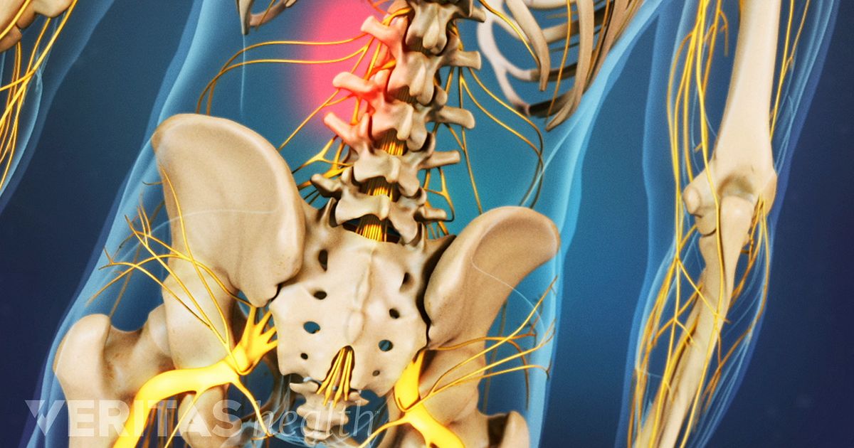 dolor de espalda y cuello se explica
