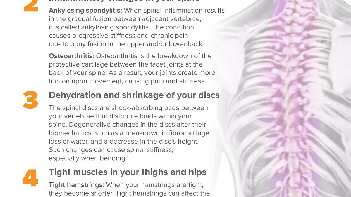 Common Causes of Stiff Back and How to Get Relief