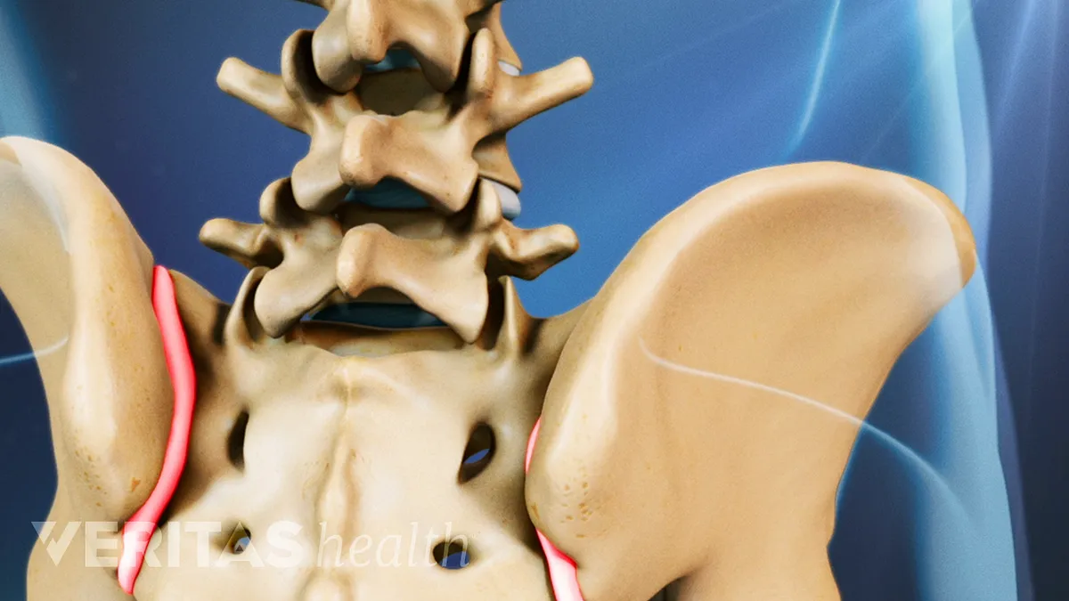 2 Little-Known Treatments to Relieve Sacroiliac Joint Pain