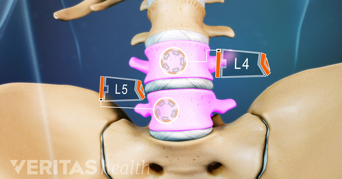 backbone definition