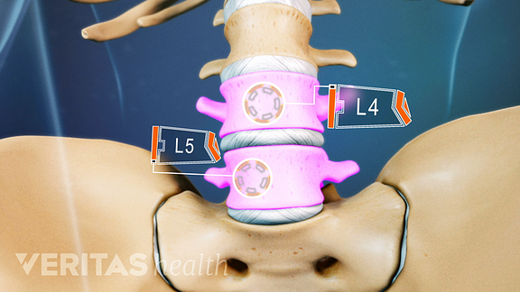 All About the L4-L5 Spinal Segment