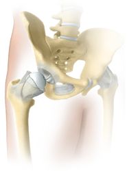Hip-Healthy