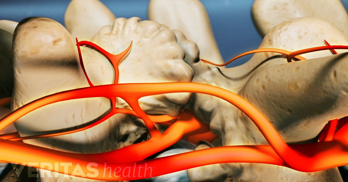 Treatment Options for Neuropathic Pain