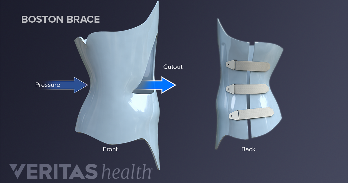 hard plastic back brace