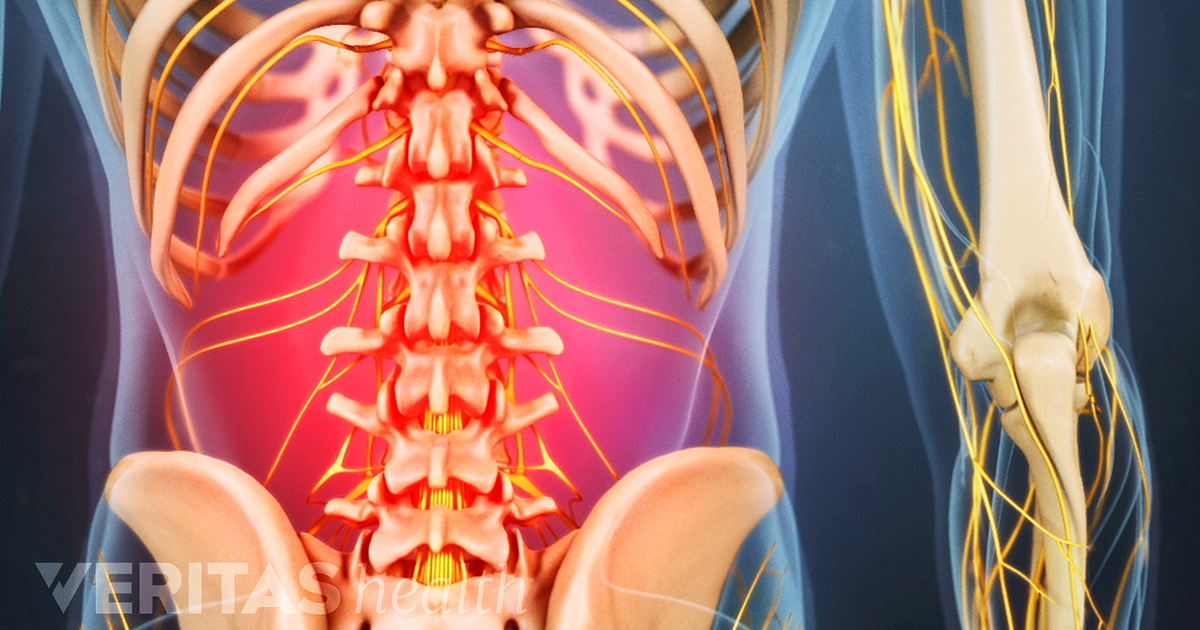 Back Muscles And Low Back Pain