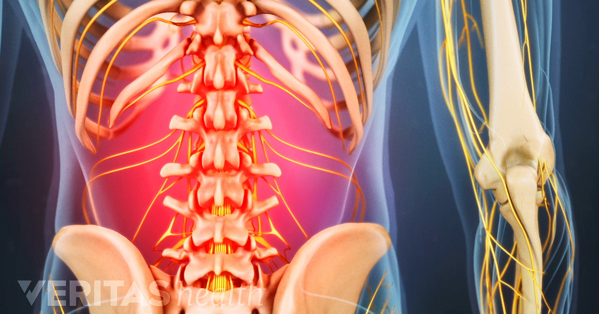 Back Muscles and Low Back Pain