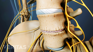 Image Result For Cracking Neck Causes Image Result For Cracking Neck Causes