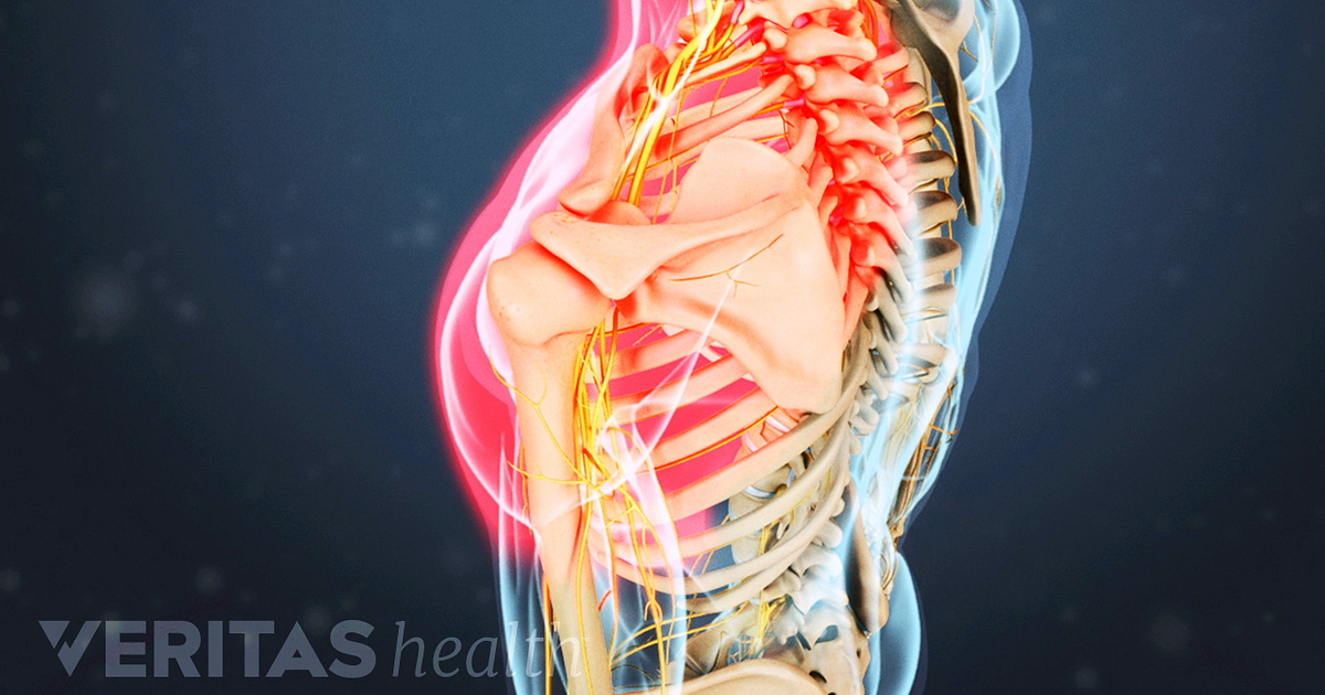 osteochondroza unguentului vertebrei cervicale hernie a durerii coloanei vertebrale în articulația șoldului