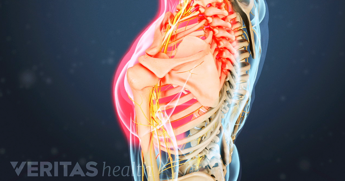 osteochondroza simptomelor de unguent cervical