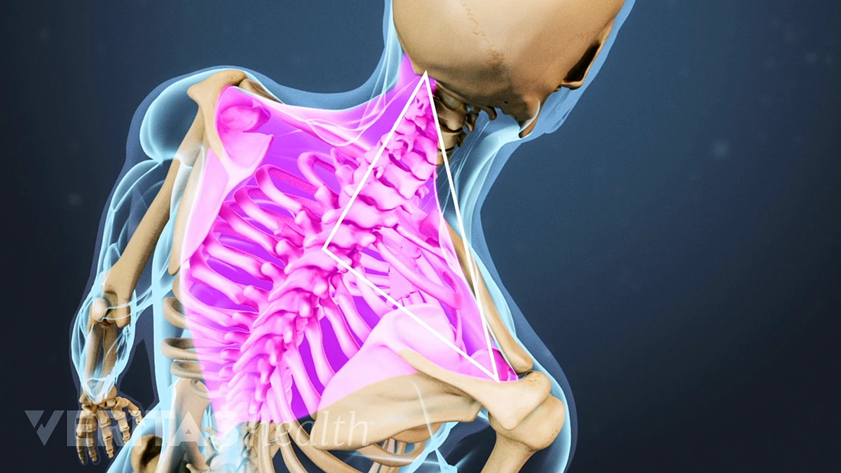 Everything You Need to Know About Your Upper Back Pain