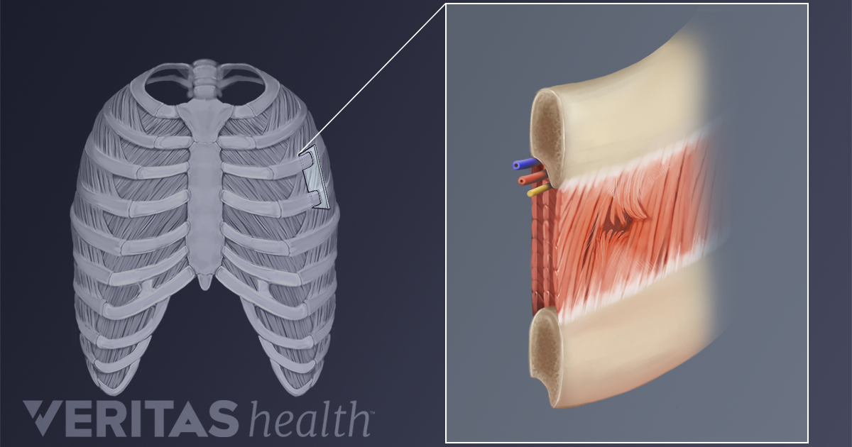 high back pain