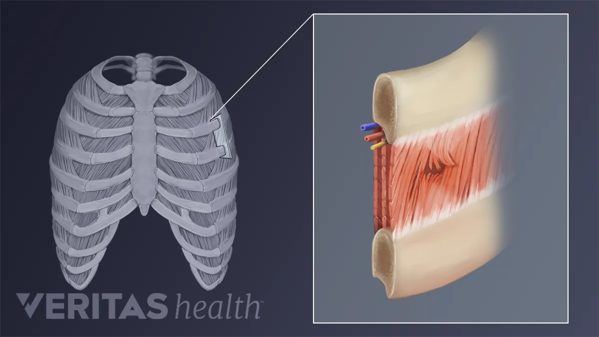 of Upper Back Pain | Spine-health