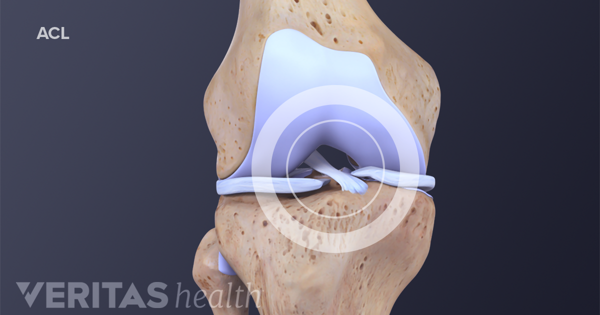 Anterior Cruciate Ligament Acl Definition Sports Injury Related