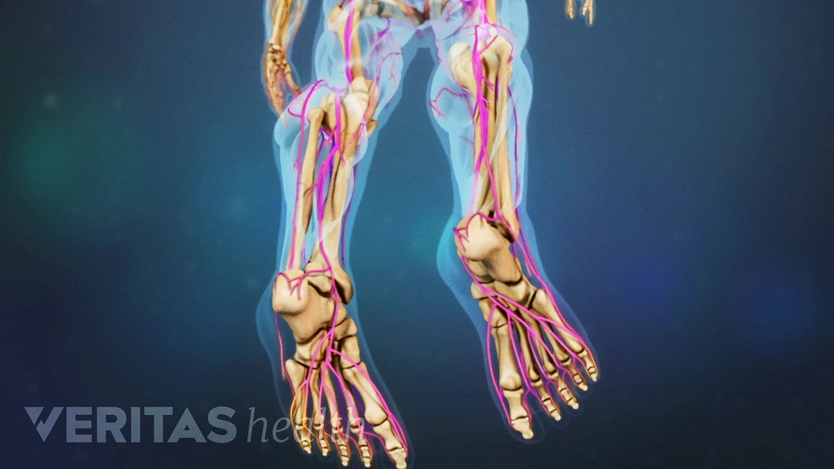 Foot drop - Diagnosis and treatment - Mayo Clinic