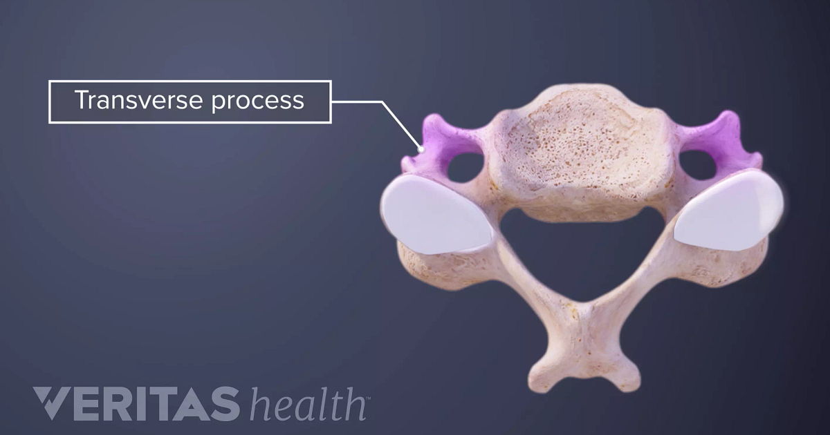 Transverse Process Definition Back Pain And Neck Pain Medical Glossary