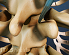 Balloon Tamp insertion in the thoracic spine.