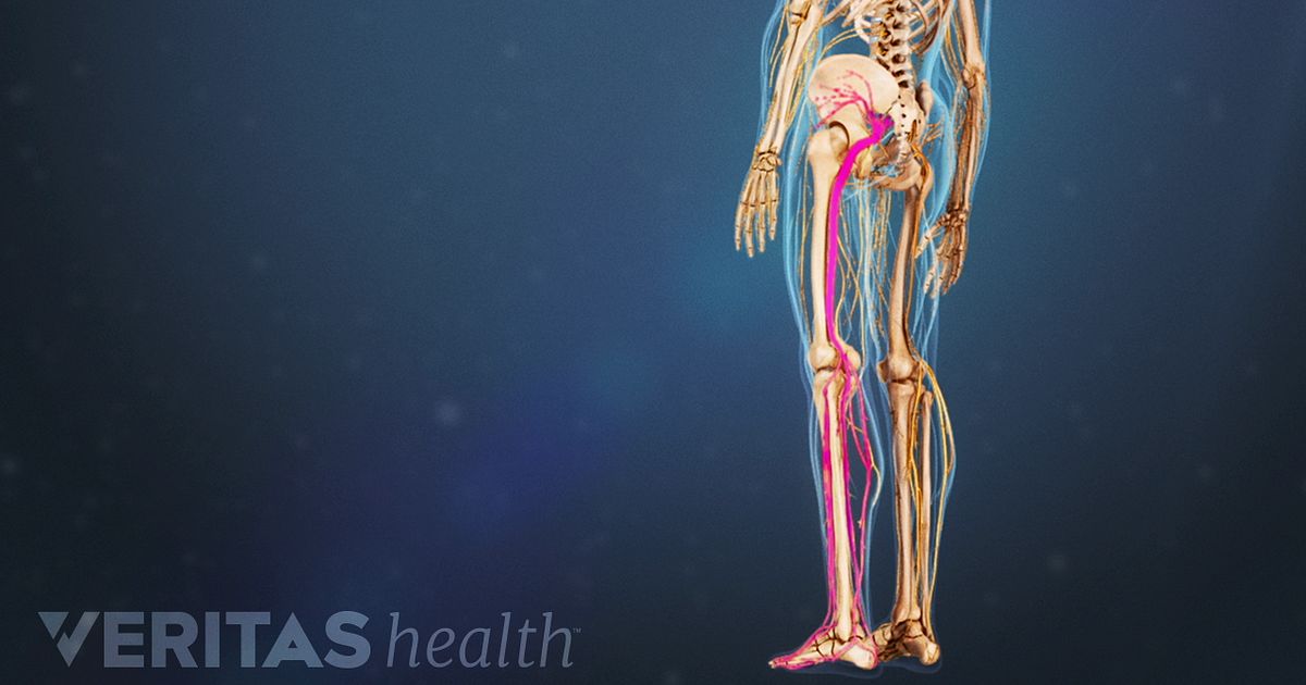 Sciatica Video: Causes and Symptoms of Sciatica anatomical diagram of foot 