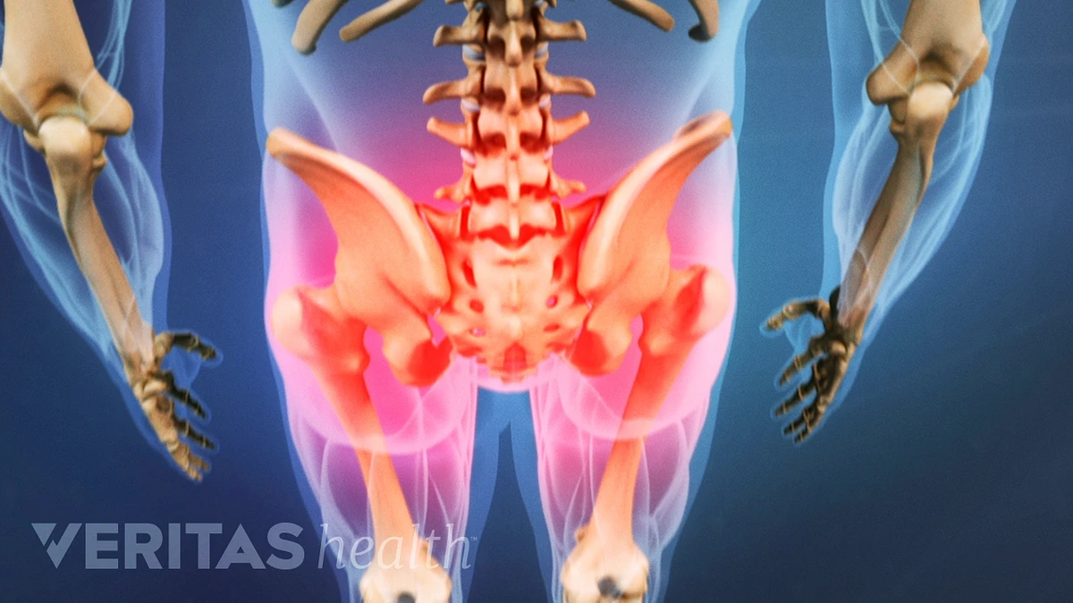 How to Tell the Difference Between Hip and Lower Back Pain