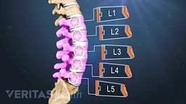 Medical illustration of lumbar vertebrae labeled L1, L2, L3, L4, L5