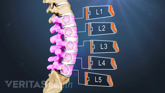 Profile view of the lumbar spine labeling L1, L2, L3, L4, and L5.