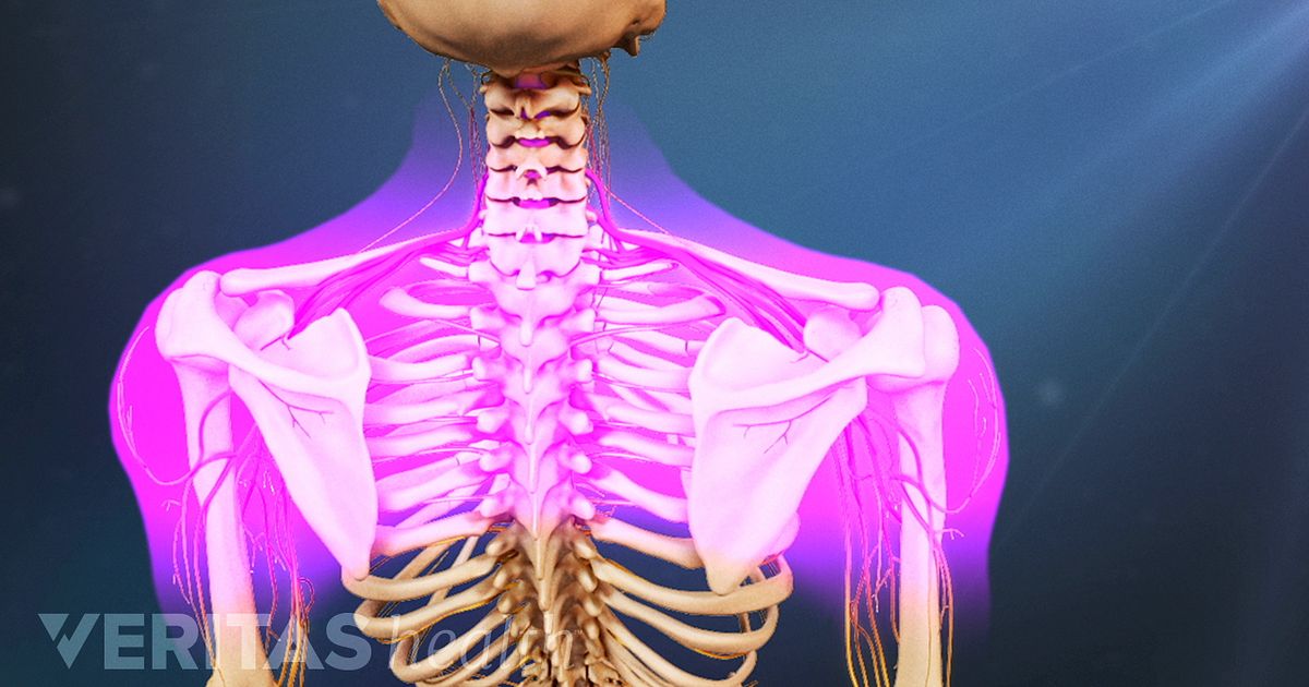 How Cervical Degenerative Disc Disease Causes Pain and Other Symptoms