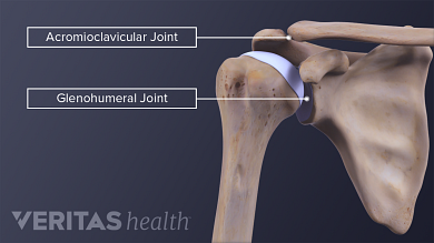 clavicularis osteoarthritis