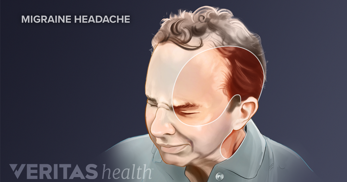 Neck Pain And Migraine Headache Neck Pain And Migraine Headache